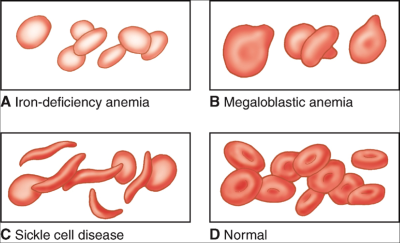 Starved of Oxygen: Understanding the Importance of Testing for Anemia